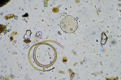 Lebendiges Bodenleben in einer Bodenprobe unter dem Mikroskop